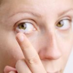 目ヤニが多いのはコンタクトが原因？考えられる目の病気の対処法を知って安全なコンタクトライフを